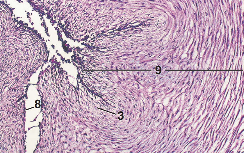 <p>Part and stain?</p>