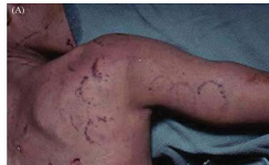 <p>Mention the type of child abuse?</p>