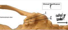 <p>What is the clinical significance of the locations for 1 and 2?</p>