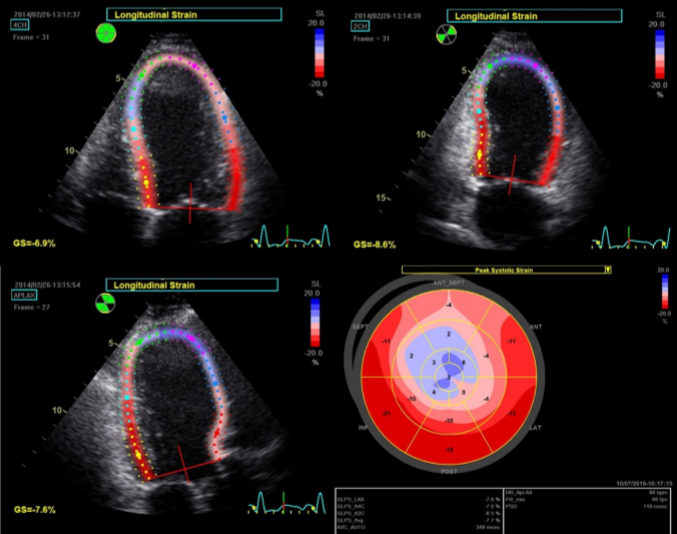 <p>Describe the findings of this image.</p>