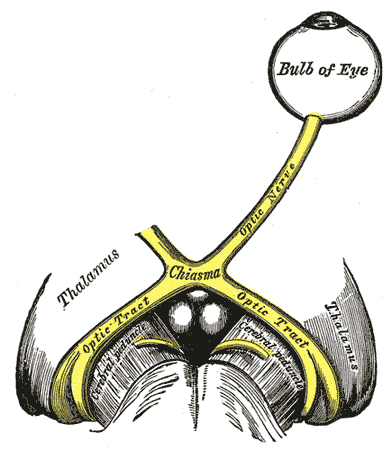term image
