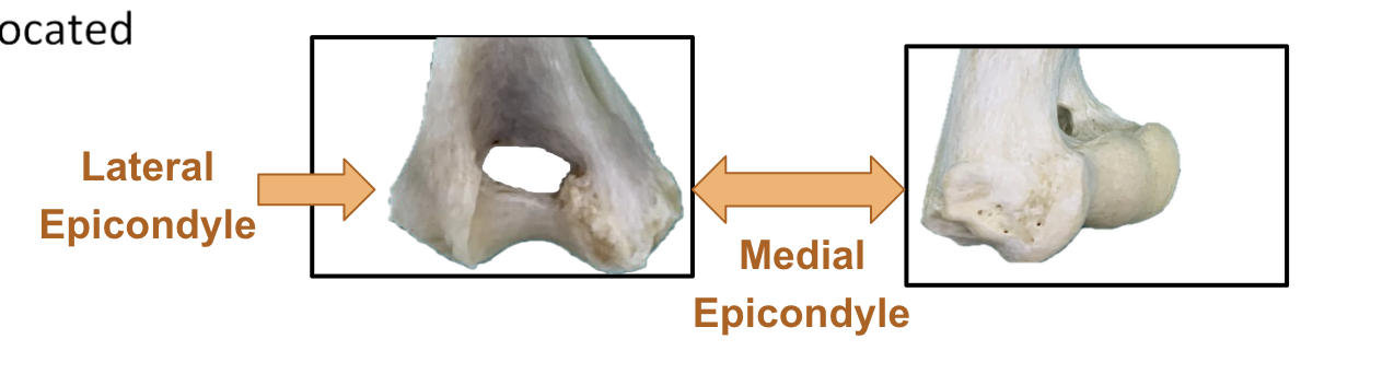 <p>A projection located ‘upon’ the condyle</p>