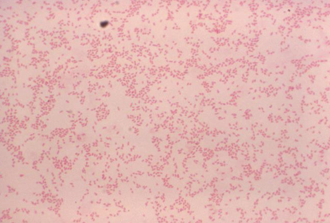 <p>what bacterial genus is described below:</p><ul><li><p><strong>faintly staining</strong> gram negative coccobacilli</p><ul><li><p>to enhance staining: substitute carbol fuchsin for safranin</p></li><li><p>extend counterstain time</p></li></ul></li><li><p>nonmotile, non acid fast, non-spore forming</p></li></ul><p></p>