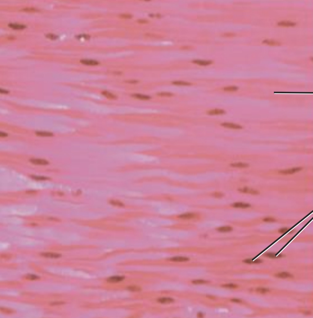 <p><span>Spindle-shaped cells with central nuclei, arranged closely to form sheets, with no striations</span></p>