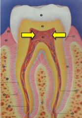 <p>Name the structure at C</p><p>Greater amounts of secondary dentin at roof and floor of the coronal portion</p>