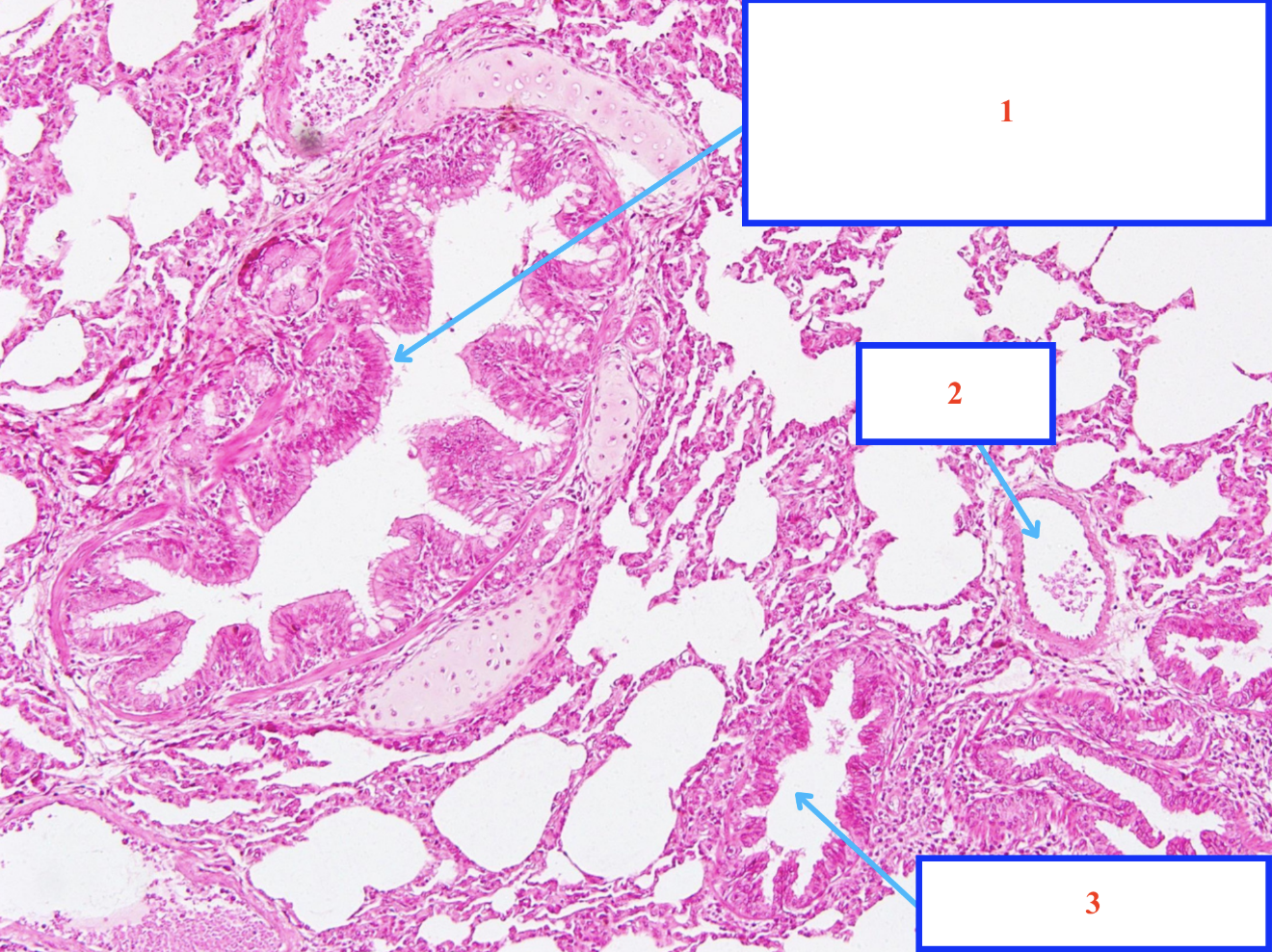 <p>Cấu trúc gì ?</p>