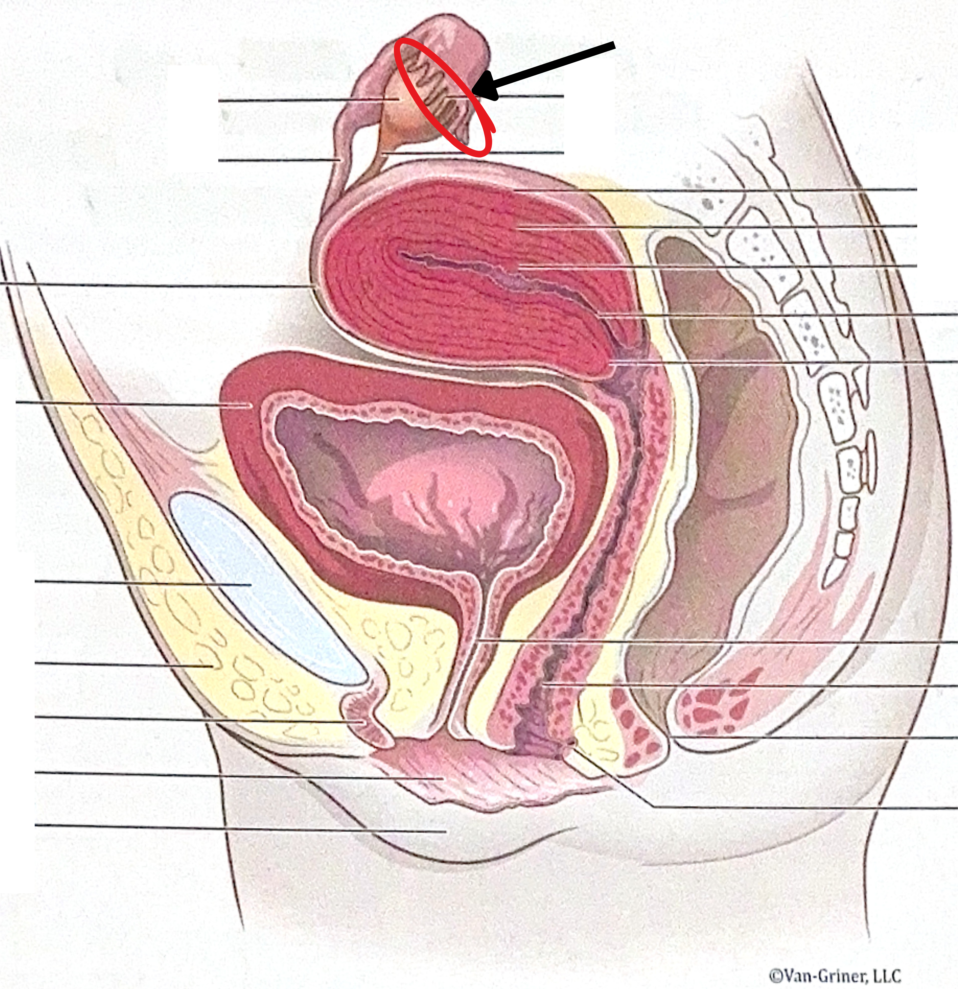 <p>What is the structure indicated in the image?</p>