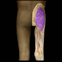 <p>what muscle is this</p>