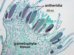 <p>Antheridia Structure</p>