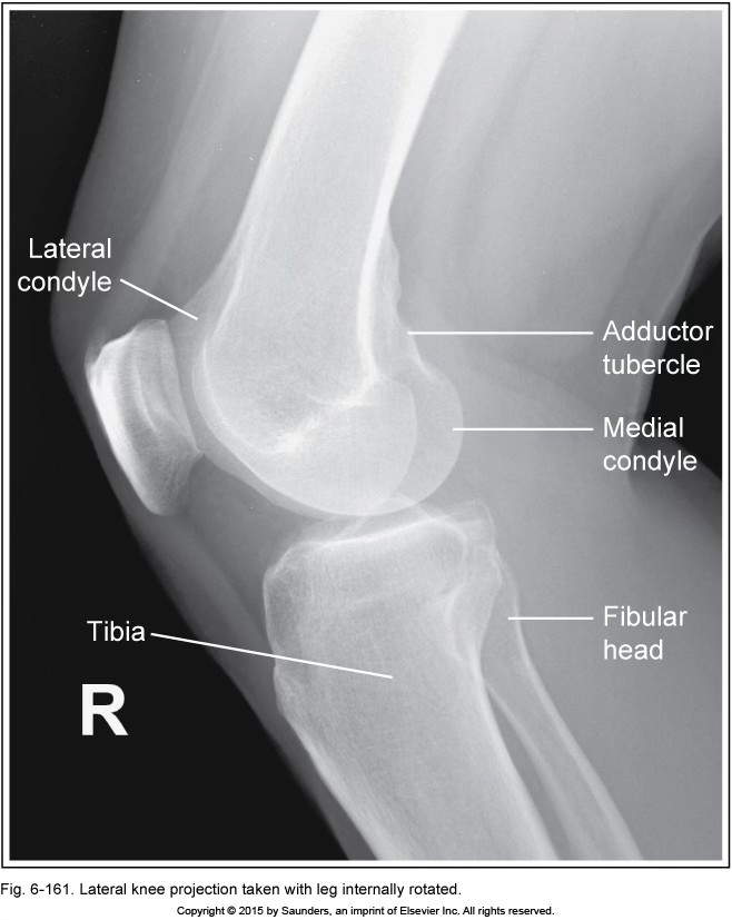 <p>lateral knee</p>