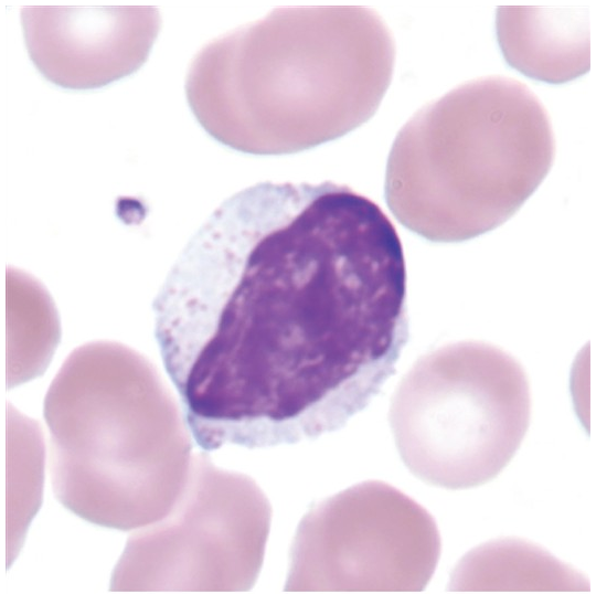 <p>what is a large lymphocyte?</p>