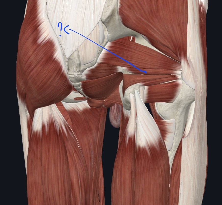 term image
