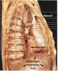 <p>Identify the nerve</p>