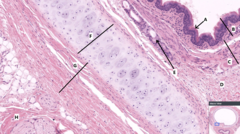 <p>Identify the type of epithelium labeled A</p>