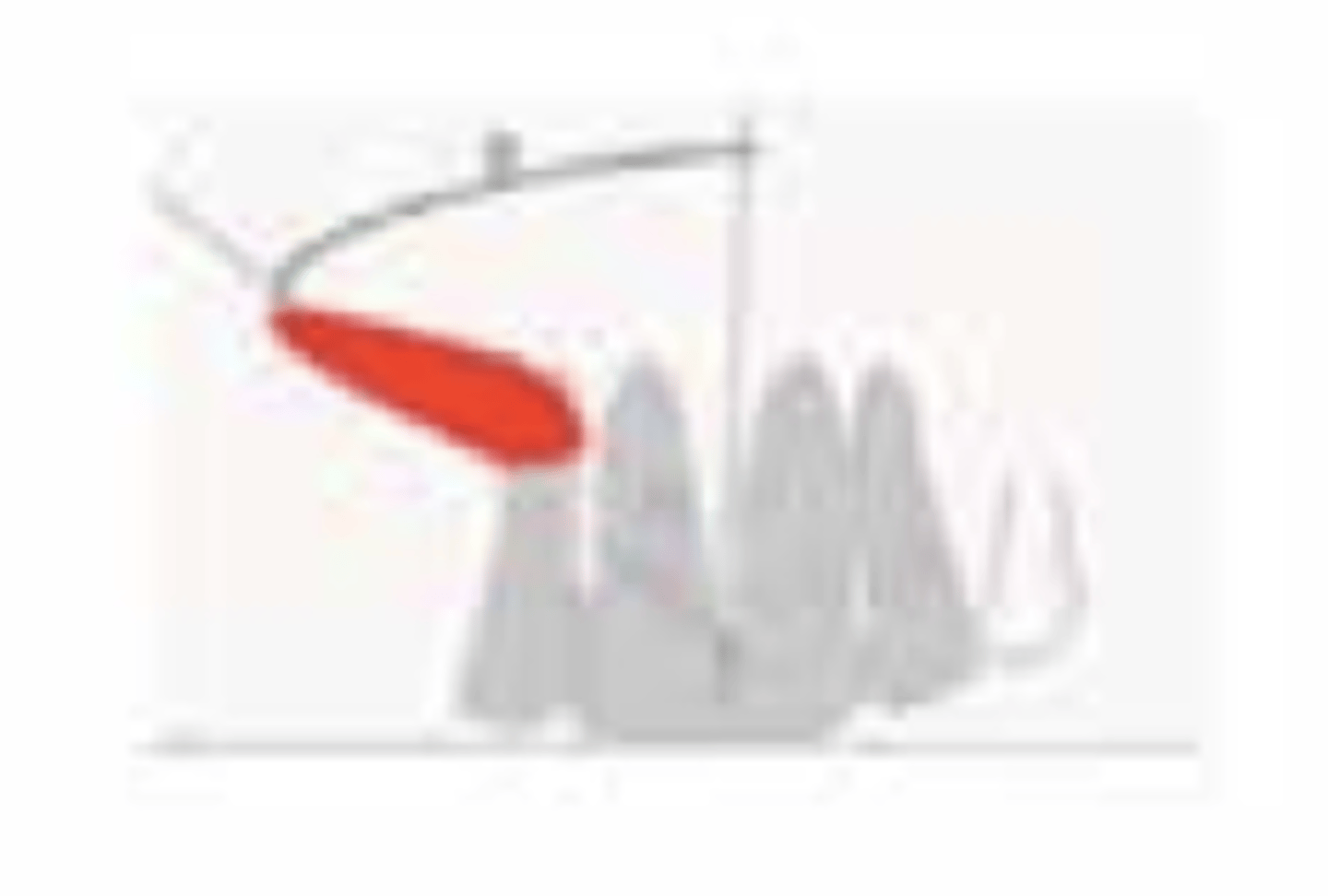 <p>What is the prognosis?</p><p>- Angulation: >30°</p>