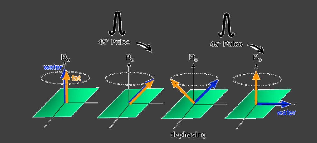 <p>Flip angle</p>