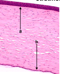 <p>histologically classify the structure arrow a is pointing to</p>