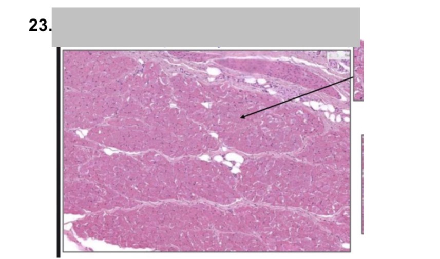 <p>esfínter anal externo </p>