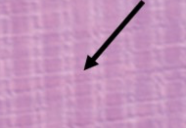 <p>identify the structure indicated by the pointer</p>