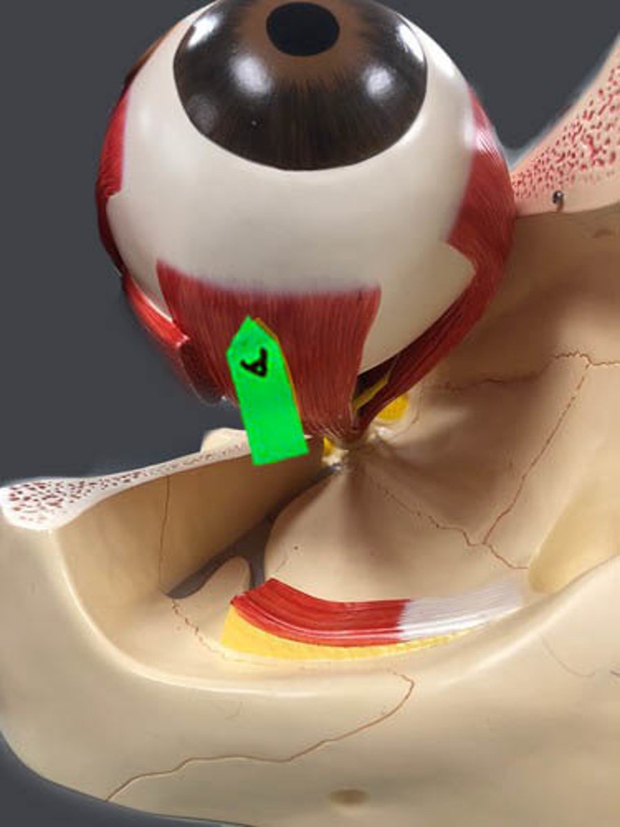 <p>Identify this muscle.</p>
