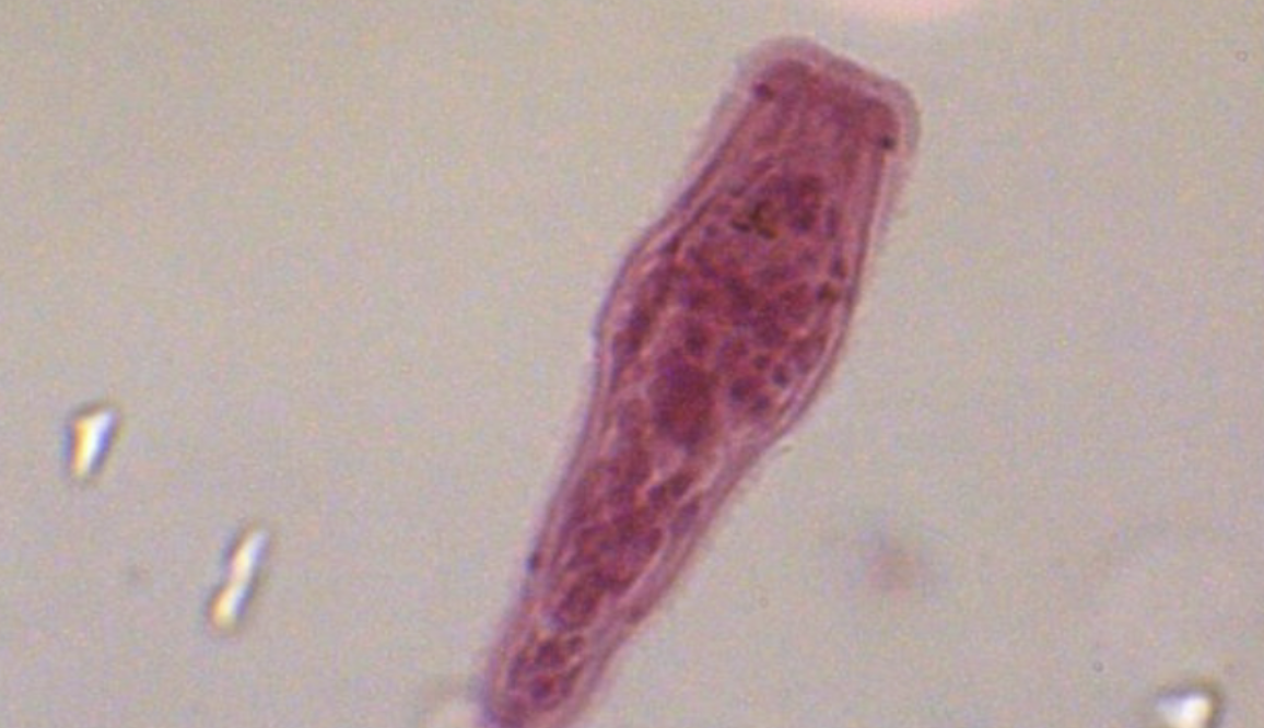 <p>What fluke is this?</p>