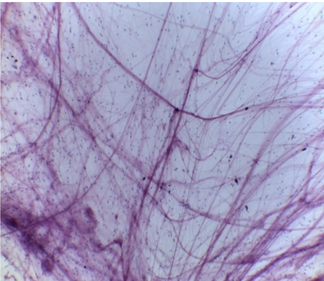 <p>Areolar Connective Tissue</p>