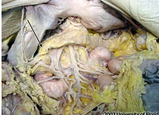 <p>what structure is pictured here (be specfic)?</p>