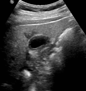 <p>Identify this image. </p>