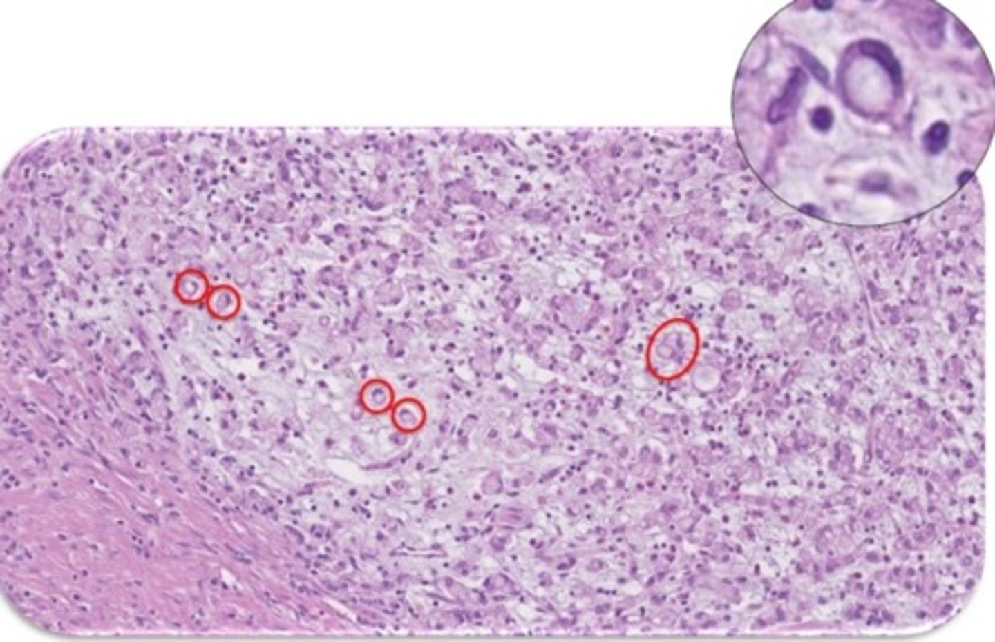 knowt flashcard image