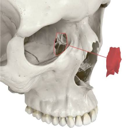 term image