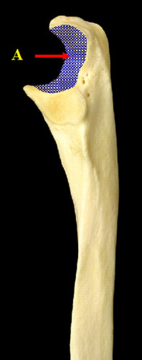 <p>deep notch that separates the olecranon and the coronoid process; articulates with the trochlea of the humerus</p>
