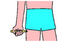 <p>Severe, life-threatening allergic reaction requiring immediate treatment with epinephrine</p>