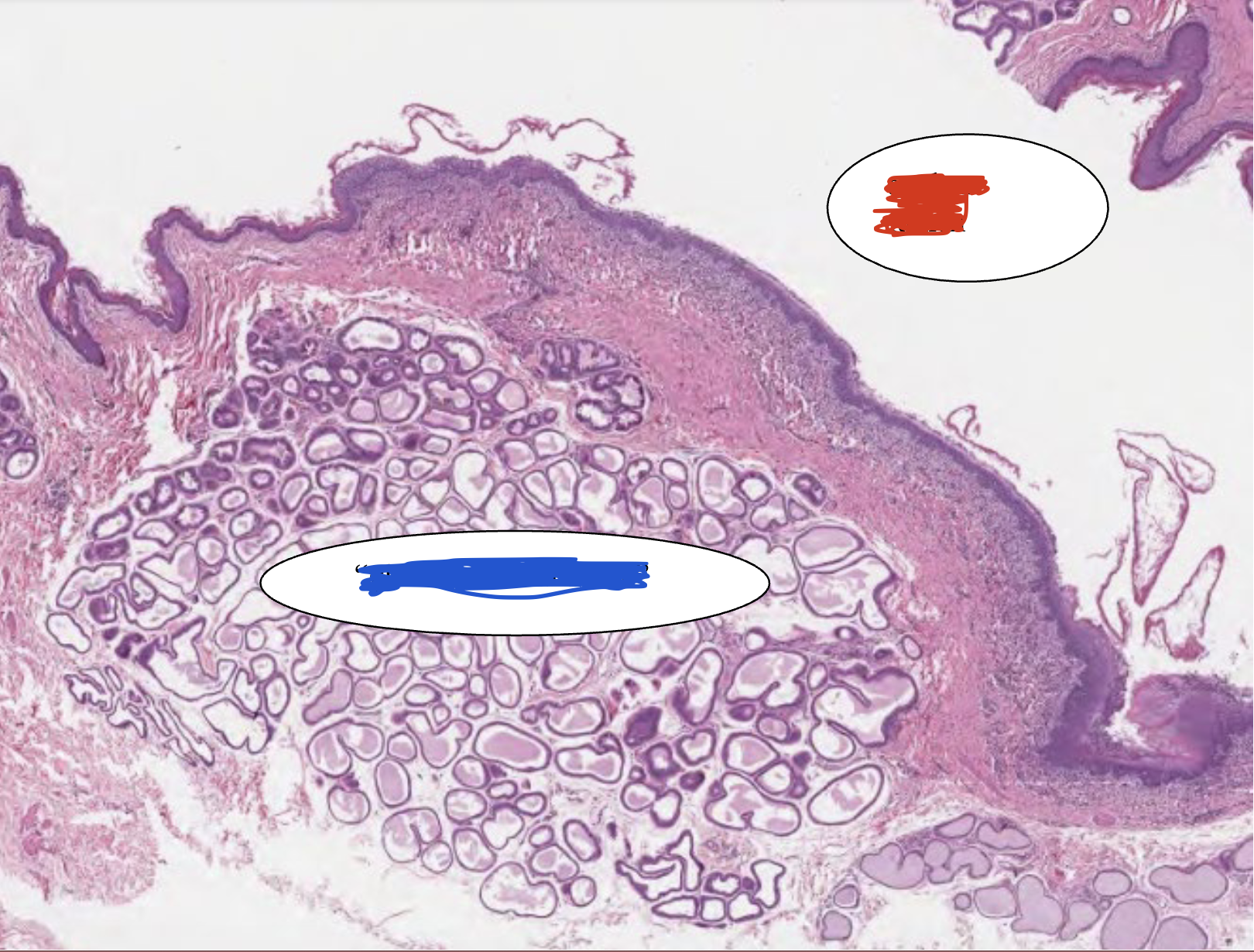 <p>This is a portion of the anal sac. What is highlighted in blue and what is highlighted in red?</p>