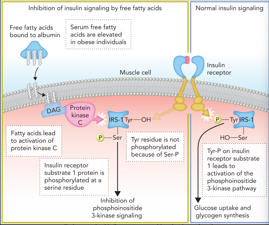 <ul><li><p>increased levels of free fatty acids lead to the production of diacylglycerol (DAG) in the plasma membrane which stimulates protein kinase C</p></li><li><p>PKC phosphorylates insulin receptor substrate 1 (IRS-1) on serine residues, which inhibits the normal phosphorylation of IRS-1 tyrosine residues by the insulin receptor </p></li><li><p>results in lack of insulin signaling leading to high glucose levels in blood </p></li></ul><p></p>