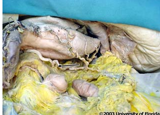 <p>which artery branches are pictured here?</p>