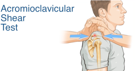 <p><strong>AC joint injury</strong></p><p>have patient seated</p><p>fold hands together and pinch palms of hands around the AC joint</p><p>positive is: reproduction of symptoms</p>
