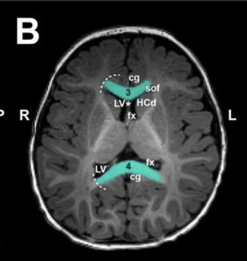 <p>Name the highlighted area</p>