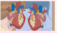 <p>A congenital condition where the heart is located on the right side of the chest.</p>