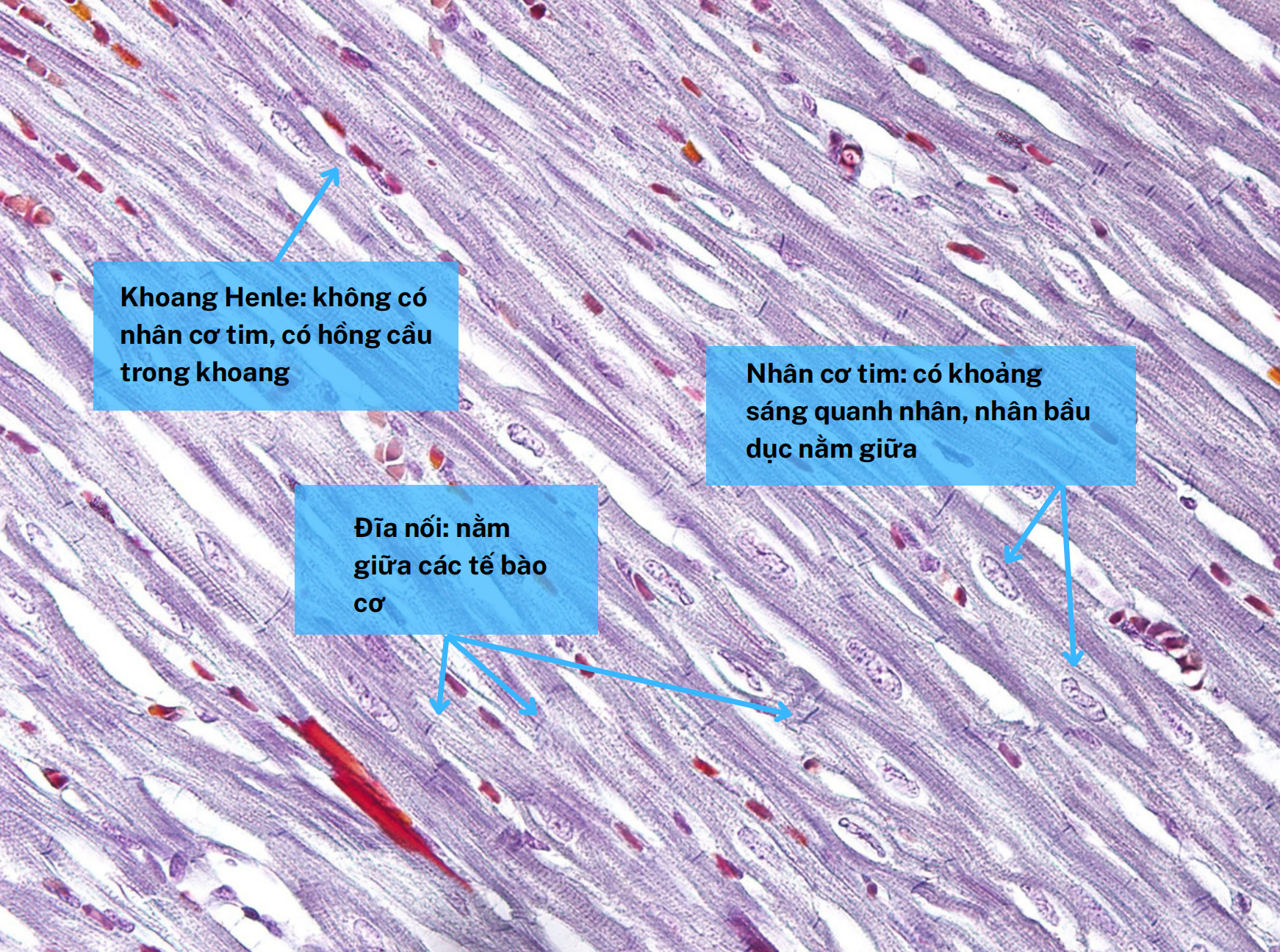<ol><li><p>Khoang Henlé</p></li><li><p>Đĩa nối</p></li><li><p>Nhân tế bào cơ tim</p></li></ol><p></p>
