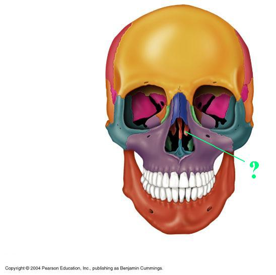 <p>Identify the indicated bone marking (projection)</p>