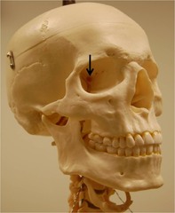 <p>a part of the sphenoid bone</p>