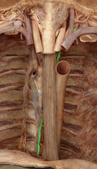 <p>Identify the structure</p>