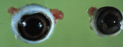 <ul><li><p><strong>Small eye</strong></p><ul><li><p>Microphthalmia = congenital</p></li><li><p>Phthisis bulbi = acquired</p></li></ul></li><li><p><strong>Large eye</strong></p><ul><li><p>Buphthalmus</p></li><li><p>Typically associated with glaucoma</p></li></ul></li></ul><p></p>