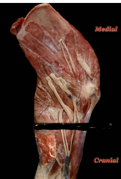 <p>Thin strap-like muscle located on the medial aspect of the brachium</p><ol><li><p>origin </p></li></ol><p>Fascia of the latissimus Dorsi muscle </p><ol start="2"><li><p>insertion </p></li></ol><p>olecranon process</p><ol start="3"><li><p>action </p></li></ol><p>extends the elbow joint</p><p></p>