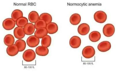 <p>NORMOCYTIC</p>