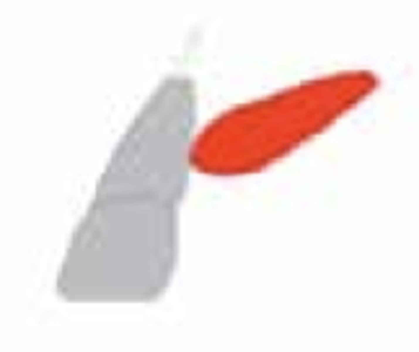 <p>What is the prognosis?</p><p>- No horizontal overlap of incisor</p>