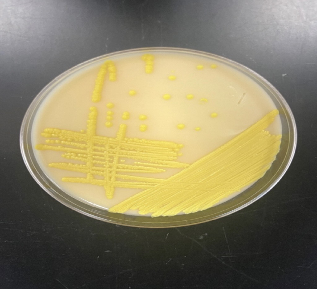 <p>Micrococcus luteus</p>