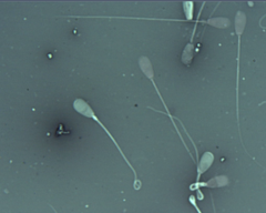 <p>What is this sperm morphology?</p>