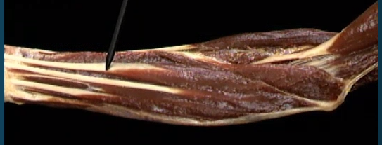 <p>Onder arm, anterior zicht</p>