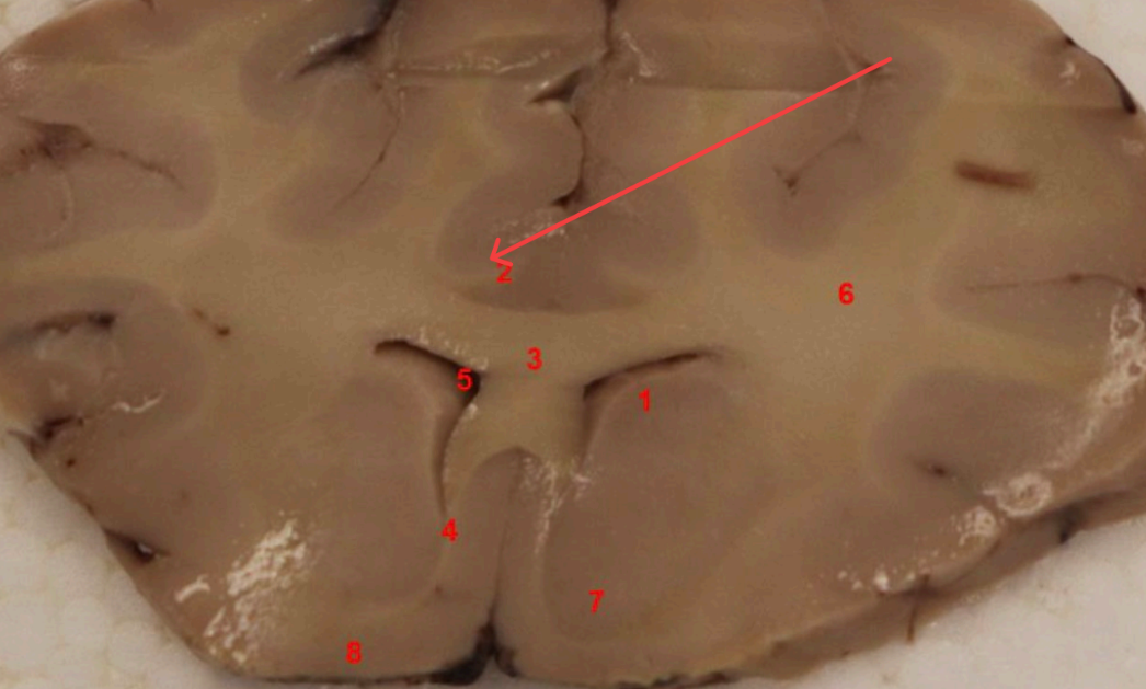 <p>what tract is this, ? </p>